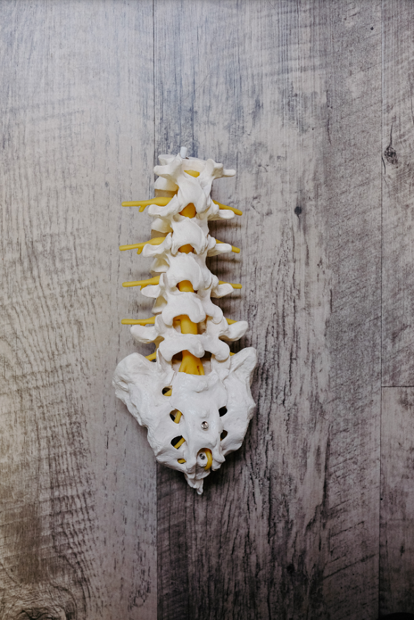 All About: Tarlov Cyst